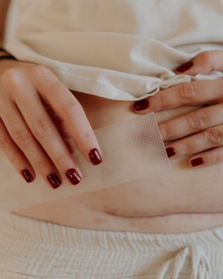 Správně zvolená péče může pozitivně ovlivnit vzhled jizvy po císařském řezu i měsíce či dokonce roky po porodu!🤯...